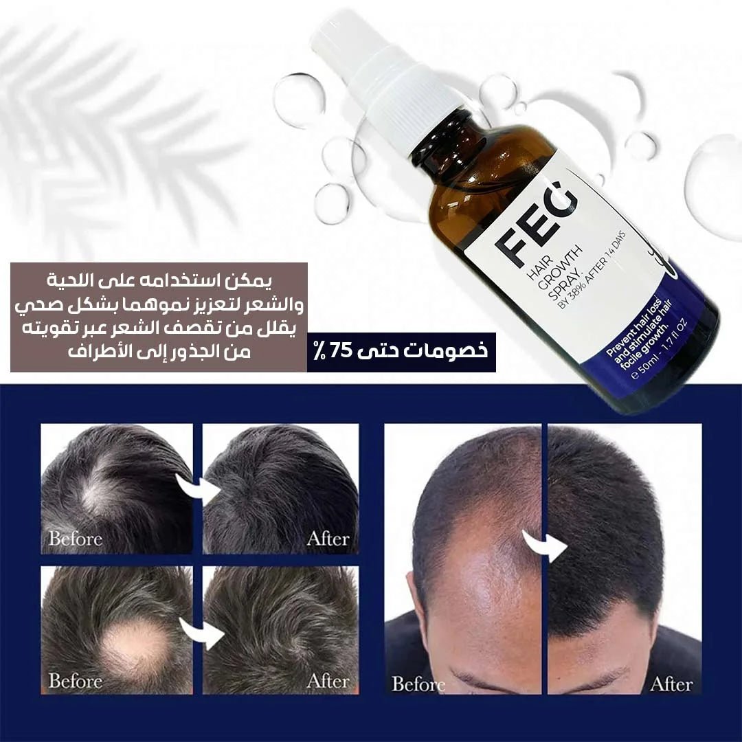 FEG Hair Growth Spray - Image 5