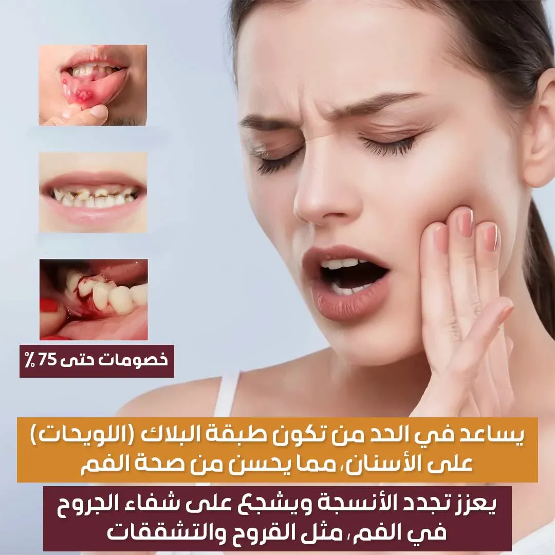 Mouth Sore Pain Spray - Image 2